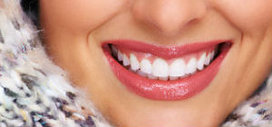 Porcelain Veneers | Dr. Canter | Anaheim, CA Dentist